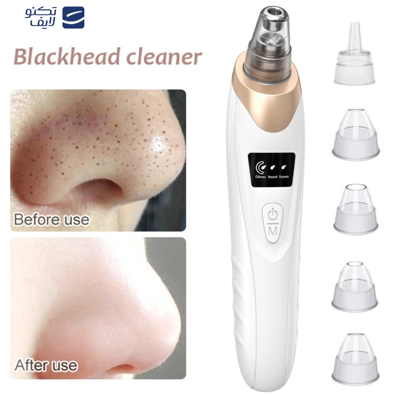 میکرودرم خانگی مدل HY9 میکرودرم خانگی مدل HY9